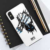 Ripped  - Phone Case